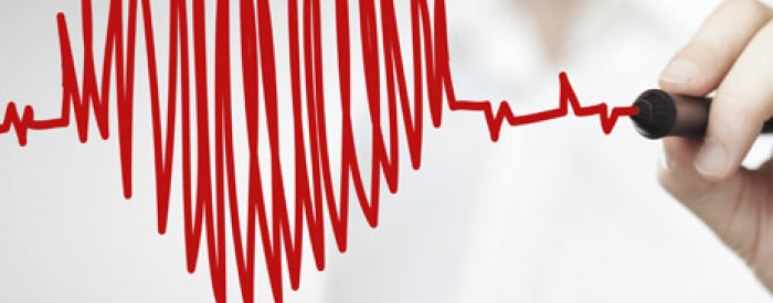 Queensland Cardiac Outcomes Registry